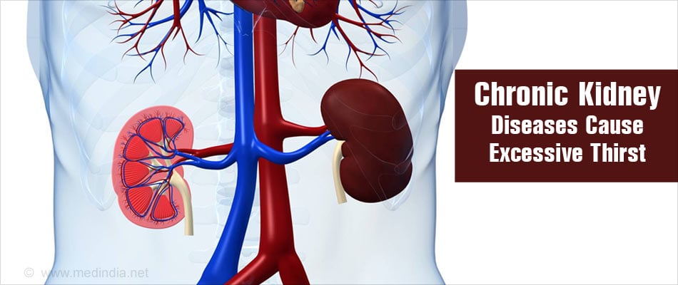 Polydipsia (Excessive Thirst) - Symptom Evaluation