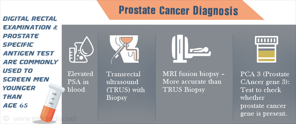 download prostate cancer diagnosis