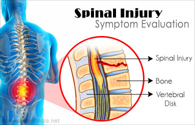 Spinal Injury - Symptom Evaluation