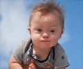 Top 10 Facts on Down Syndrome