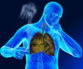 Interesting Facts and Statistics about Tuberculosis