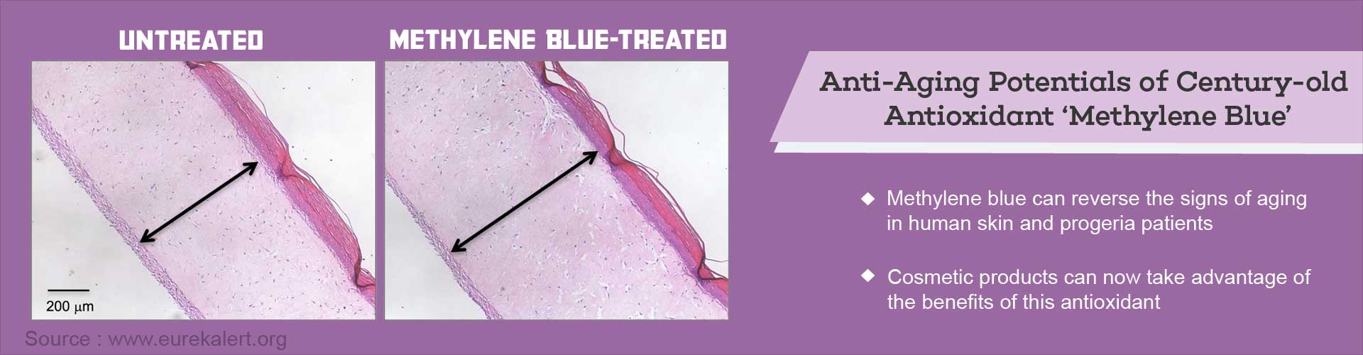 methylene blue antidote