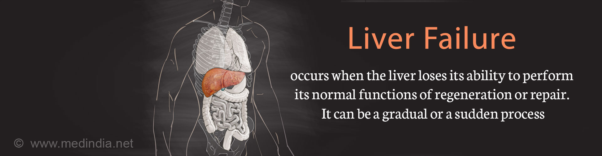 liver-failure-types-causes-symptoms-complications-diagnosis