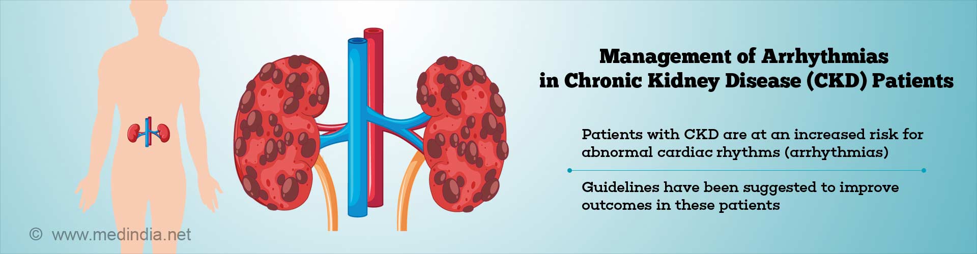 Conclusions from the Kidney Disease: Improving Global Outcomes (KDIGO ...