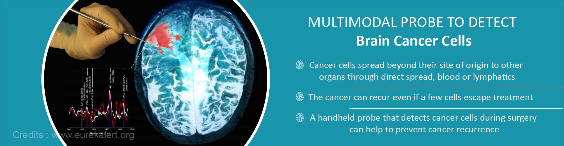 Brain Cancer Cells Detected by Multimodal Probe can Prevent Recurrence