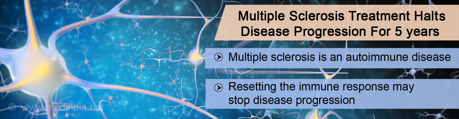 New Treatment for Multiple Sclerosis May Halt Disease