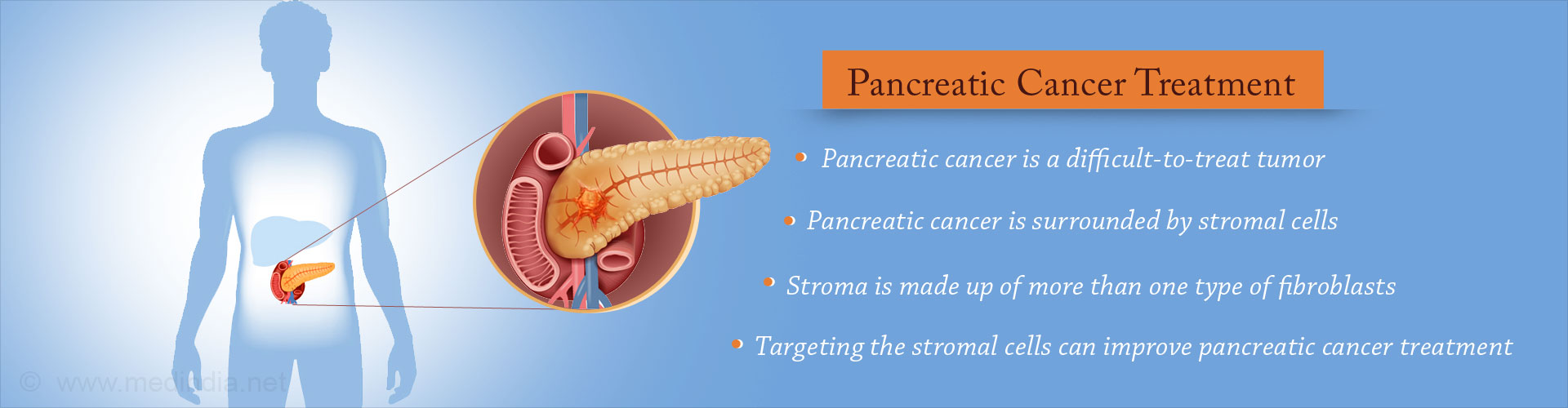 Possible New Avenues in Pancreatic Cancer Treatment
