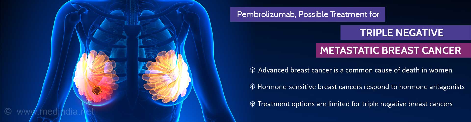 Pembrolizumab in Triple Negative Metastatic Breast Cancer