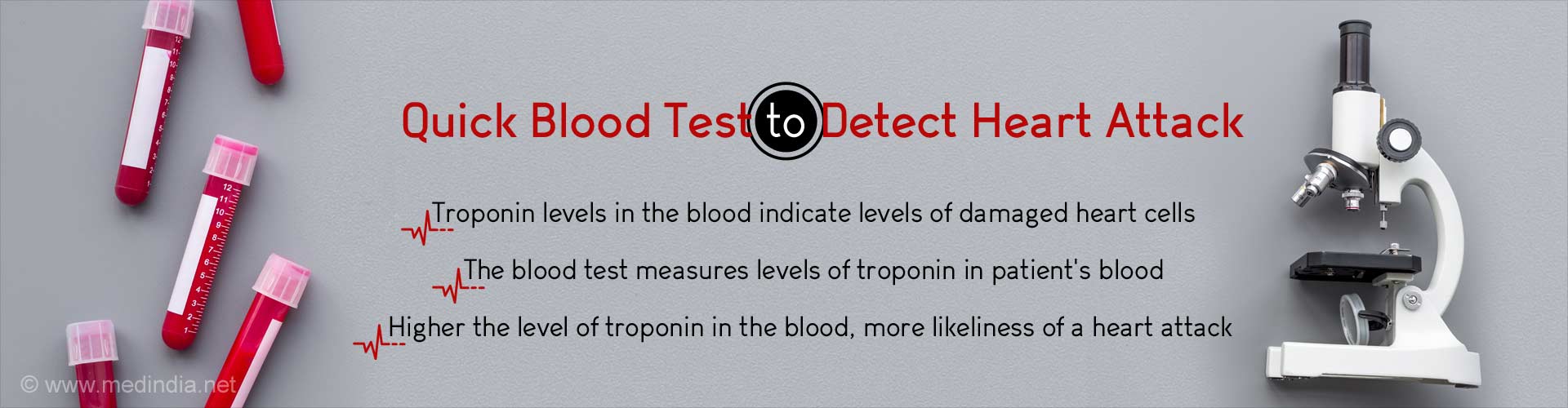 What Blood Tests Indicate Heart Attack