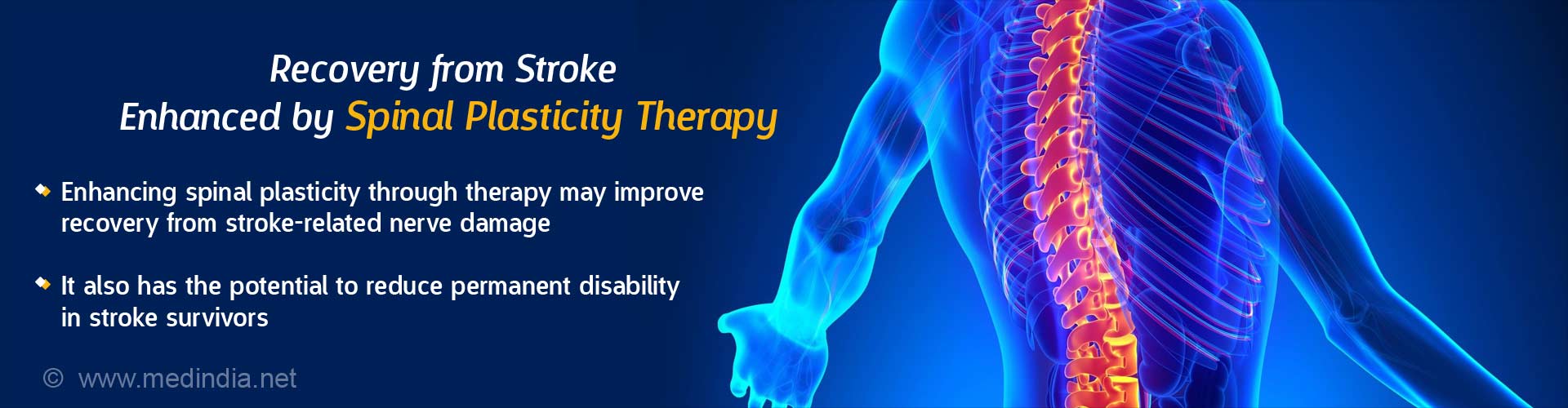 Recovery from Stroke Enhanced by Spinal Plasticity Therapy