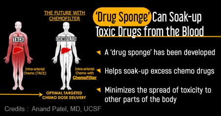 'Drug Sponge' Could Minimize Chemotherapy Side-effects - Health Tips