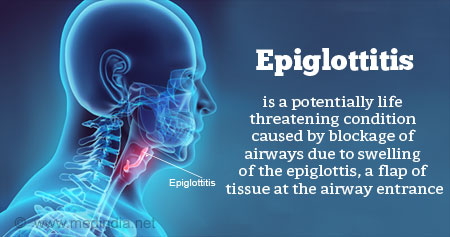 epiglottitis osteodystrophy renal epiglottis