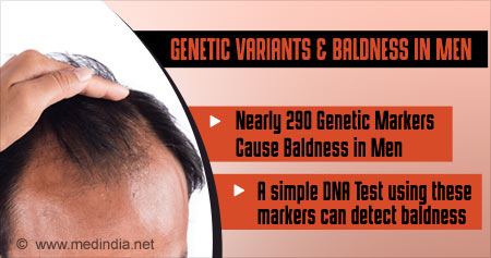 Health Tip on Baldness in Men - Health Tips