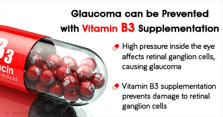 Health Tip On Prevention Of Glaucoma - Health Tips