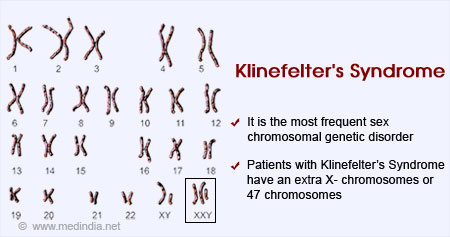 Health Tip on Klinefelter's Syndrome - Health Tips