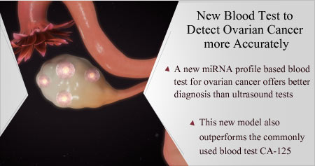 online heart test Ovarian Health on Tip New Blood to Cancer Test Detect