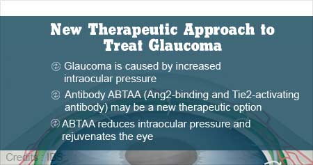 Health Tip On New Therapeutic Approach To Treat Glaucoma - Health Tips