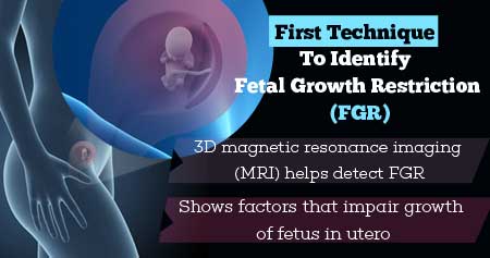 Health Tip on First Technique To Identify Fetal Growth Restriction (FGR ...