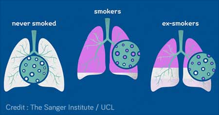 Quitting Smoking can Reduce Risk of Lung Cancer - Health Tips