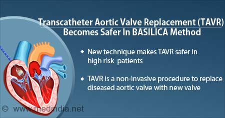 Health Tip on New Technique Reduces Risk of Coronary Obstruction During ...