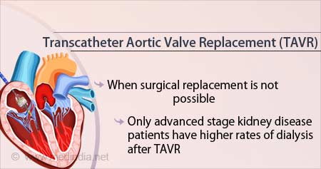 Health Tip on Risk of Dialysis in Kidney Patients After Transcatheter ...