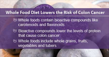 Health Tip On Whole Foods To Lower Risk Of Colon Cancer - Health Tips