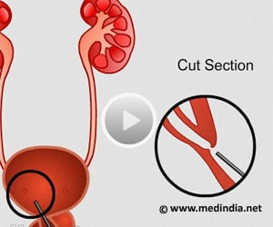 Ureteric False Passage