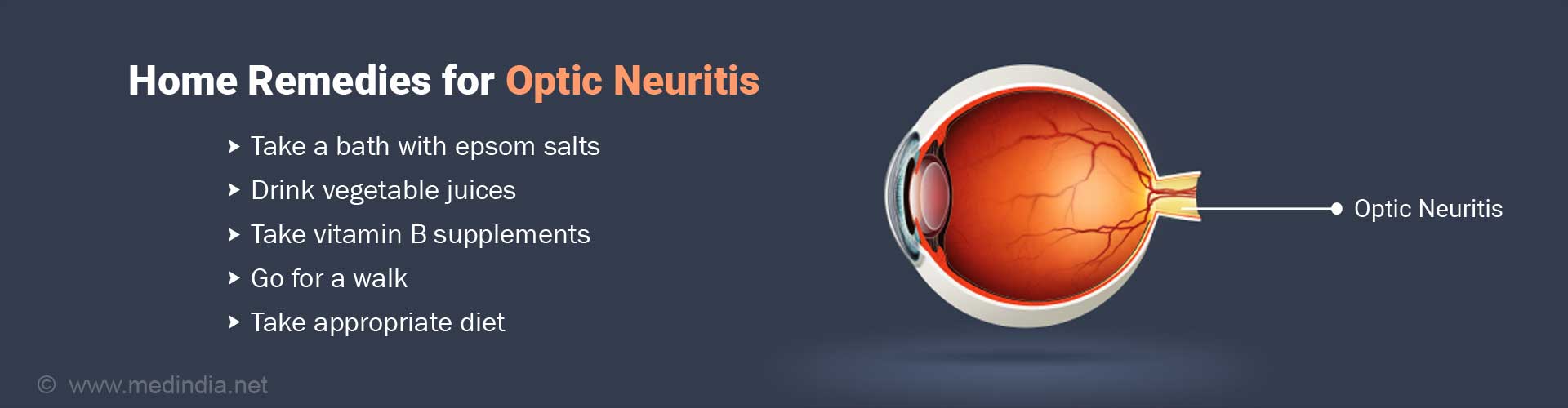 home-remedies-for-optic-neuritis