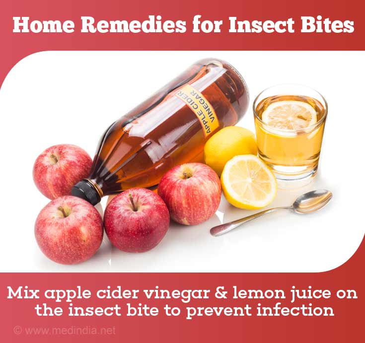 home-remedies-for-insect-bites