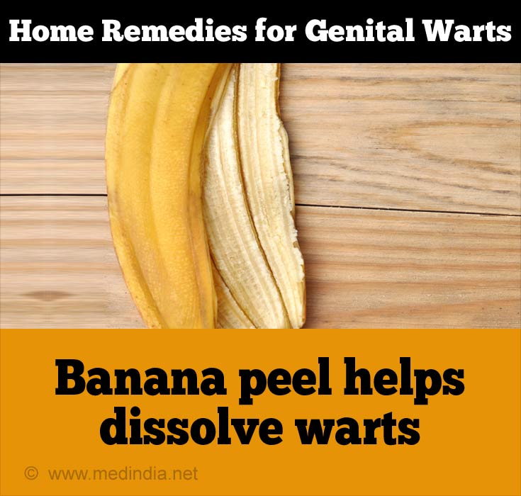 Banana Peel for Genital Warts