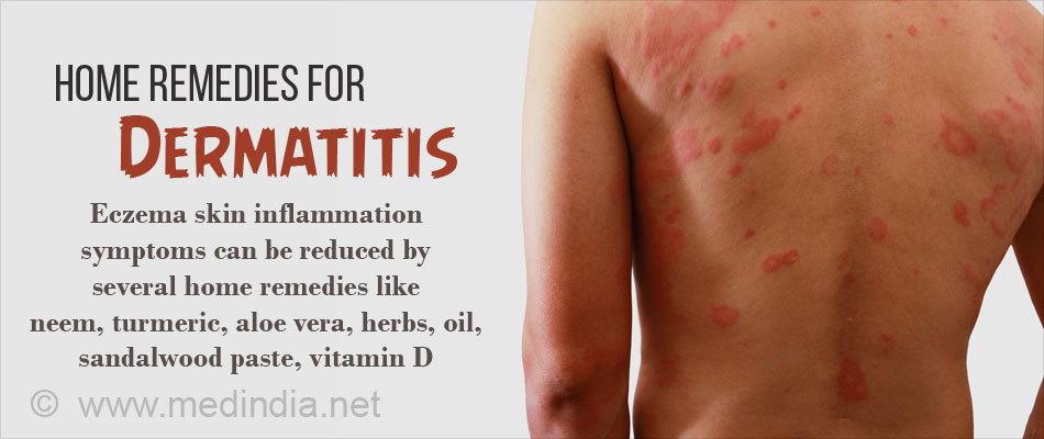 Home Remedies for Dermatitis