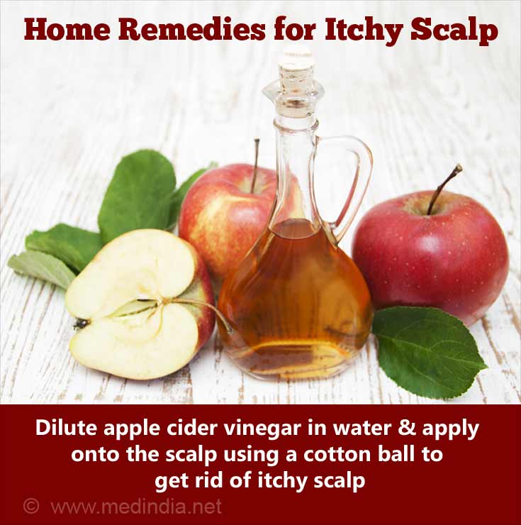 Home Remedies For Itchy Scalp