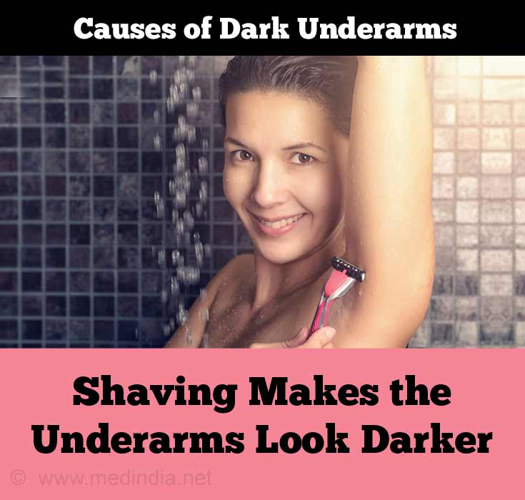 Shaving Causes Dark Underarms