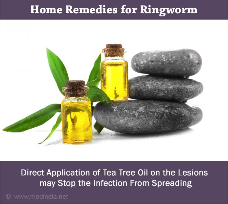 home remedies for ringworm