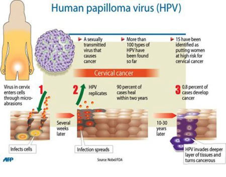 Cervical Cancer Screening - Infographic