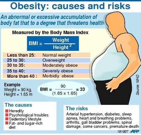 Obesity - Diagnosis - Infographic