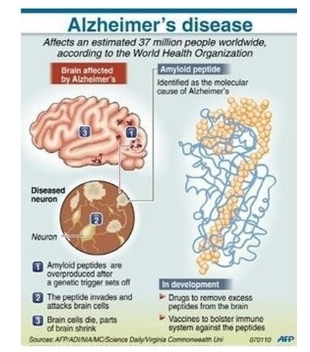 Alzheimer's disease - Gene Boosts Memory - Infographic