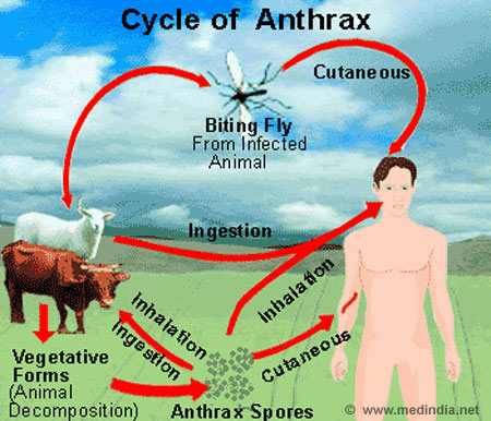 Anthrax - Infographic