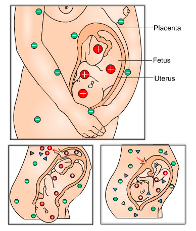 Blood Group and Rhesus (Rh) Antibodies - Infographic