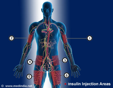 Insulin Injections for Diabetes - Infographic