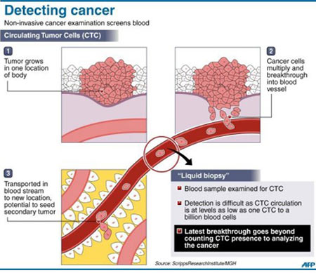 Leukemia Detection - Infographic