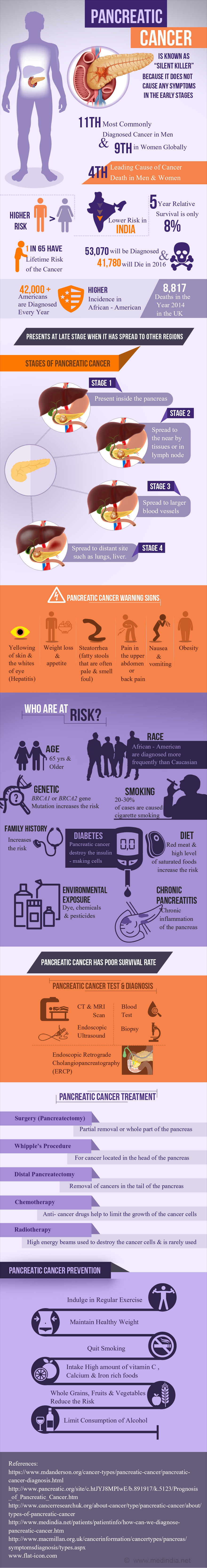 Pancreatic Cancer - Infographic