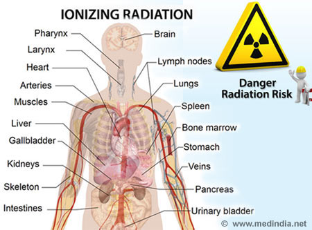 Radiation Hazards - Infographic