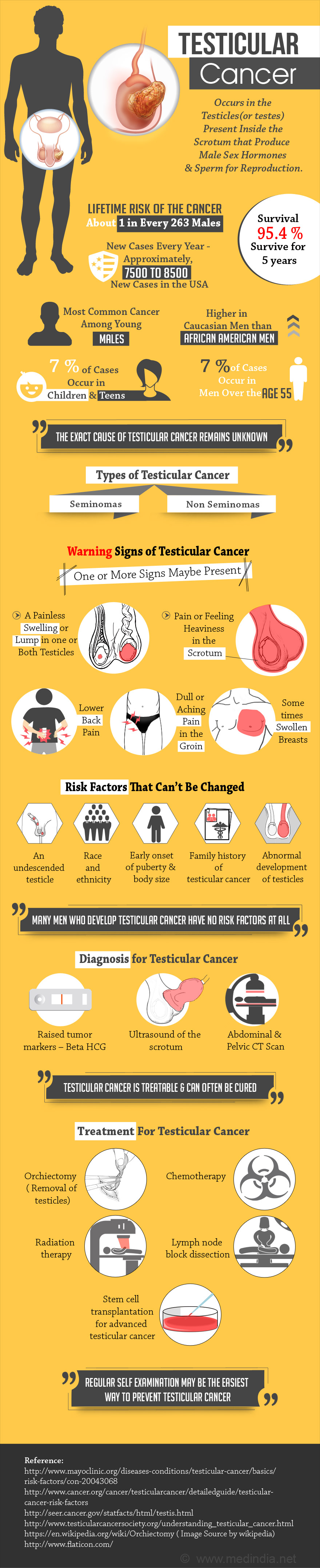 Testicular Cancer - Infographic