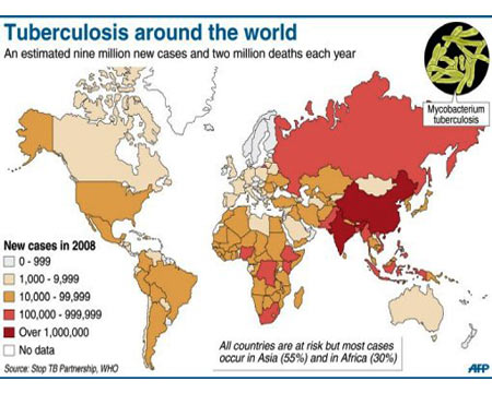 Tuberculosis - Complications - Infographic