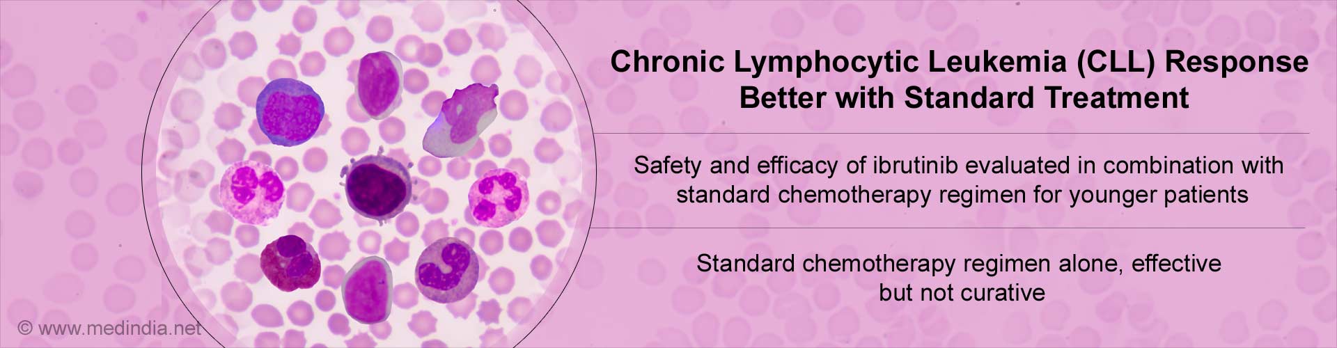 Combined Chemotherapy And Targeted Molecular Therapy Boosts Response In