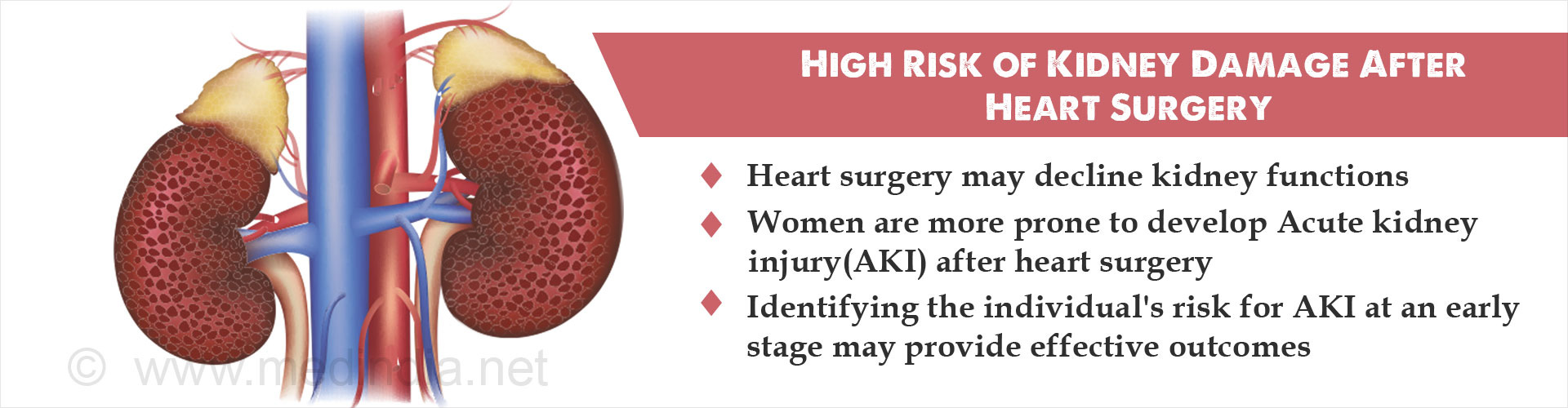 higher-risk-of-kidney-damage-after-heart-surgery-not-restricted-to-women