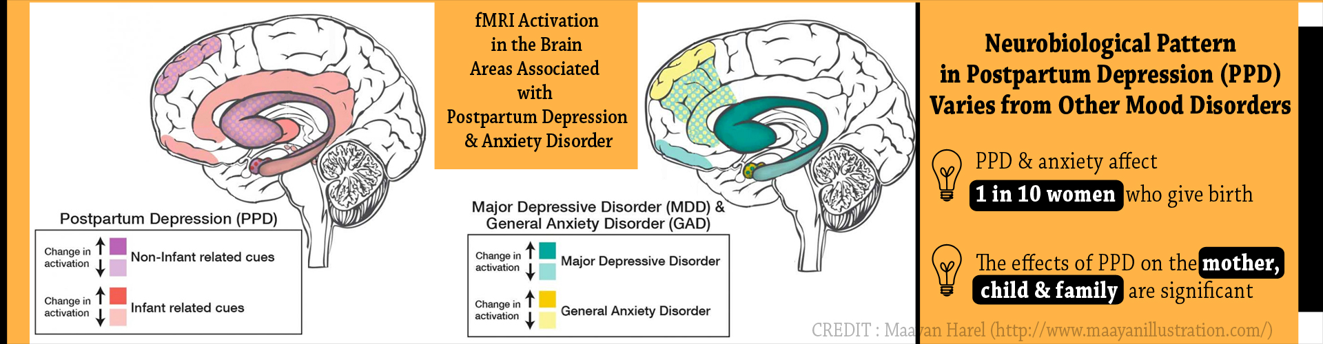 Postpartum Depression And Anxiety Differ From Other Mood Disorders