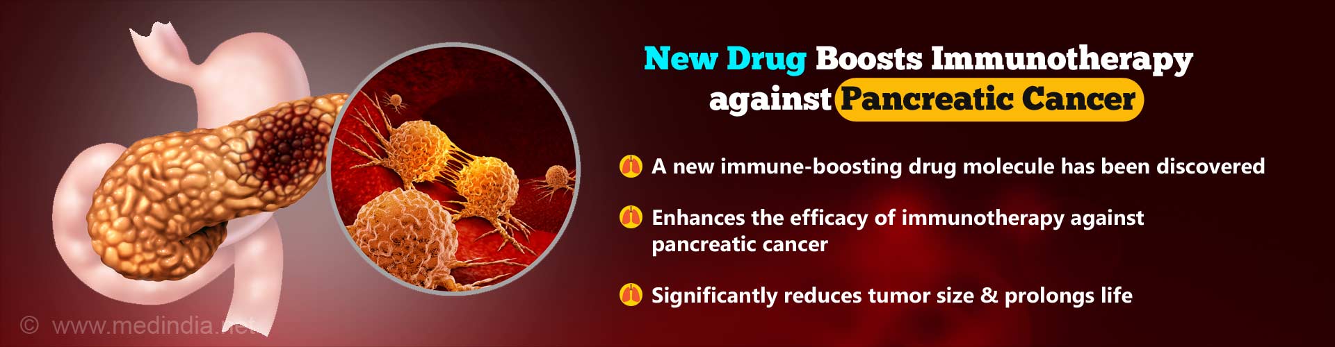 Immunotherapy For Pancreatic Cancer In India CancerWalls