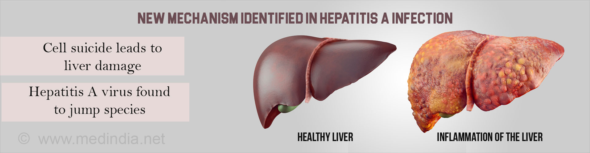 hepatitis liver damage